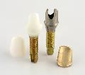 Implant Dentar
