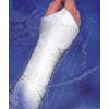 Banda de ghips hibrid - material compozit Dynacast P II