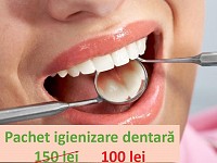 DETARTRAJ, PERIAJ SI FLUORIZARE