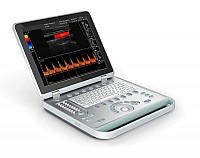 Ecografe doppler color