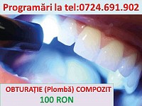 OBTURATII COMPOZIT FOTOPOLIMERIZABIL