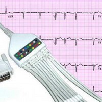 electrozi ekg